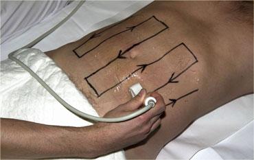 Kỹ thuật 'cắt cỏ'.