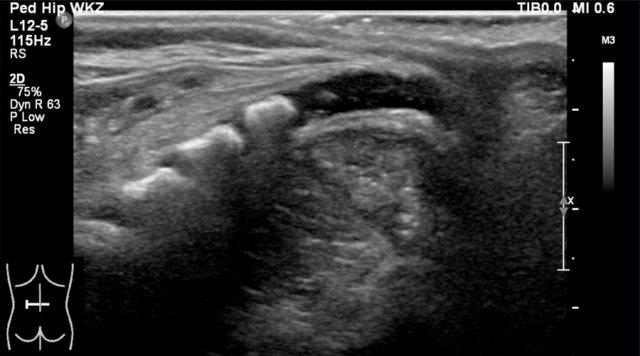 Sagittal view of a normal