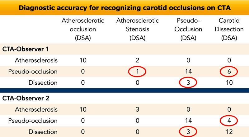 Study showing that differentiation between carotid dissection and pseudo-occlusion is difficult