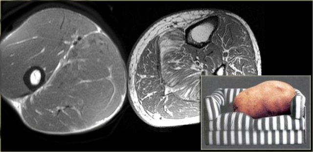 Vận động viên thể dục dụng cụ và người lười vận động