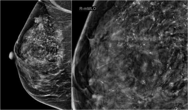 Nhấp để phóng to