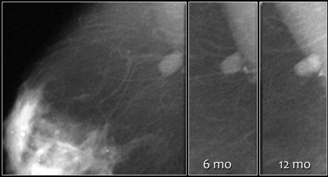 Đánh giá cuối cùng được thay đổi thành Phân loại 2