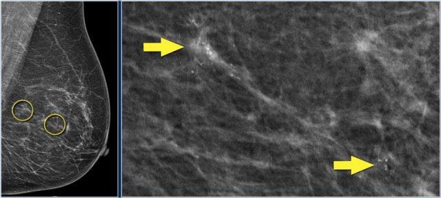 Nhấp để phóng to