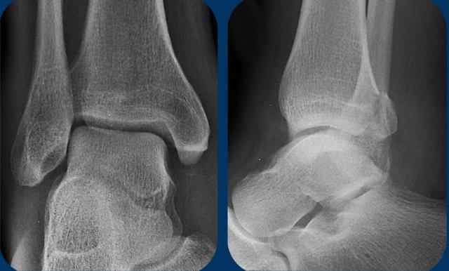 Nhấp vào hình ảnh để phóng to